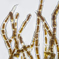 Algae & cyanobacteria
