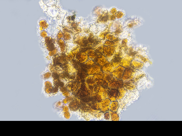 Trentepohlia cells