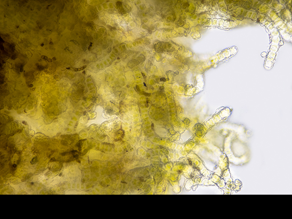 Green alga filaments and cells