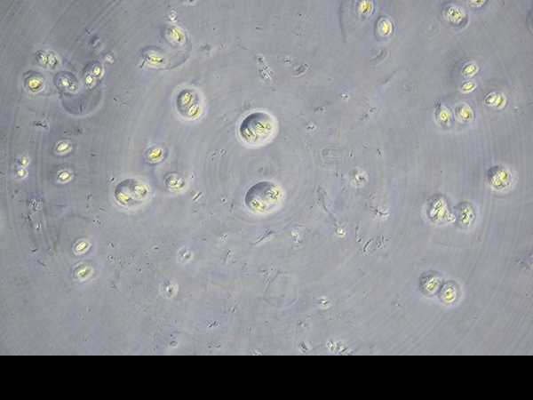 Gloeocapsa spp., a cyanobacterium