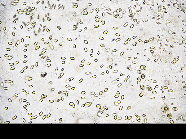 Gloeocapsa spp., a cyanobacterium