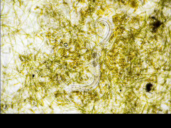 Aquatic Nematode worm with algae